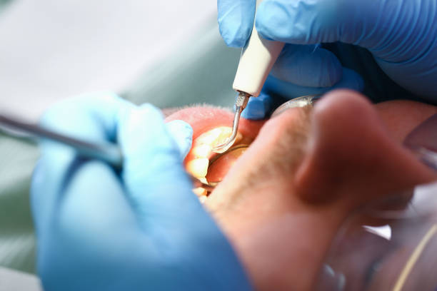 Best 24-Hour Emergency Dentist in Moundridge, KS